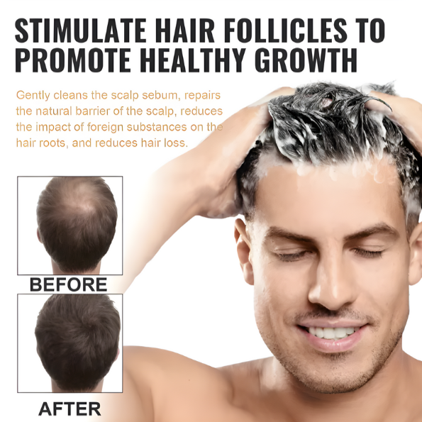 Thick & Fluffy Anti-Hair Loss Repair Shampoo